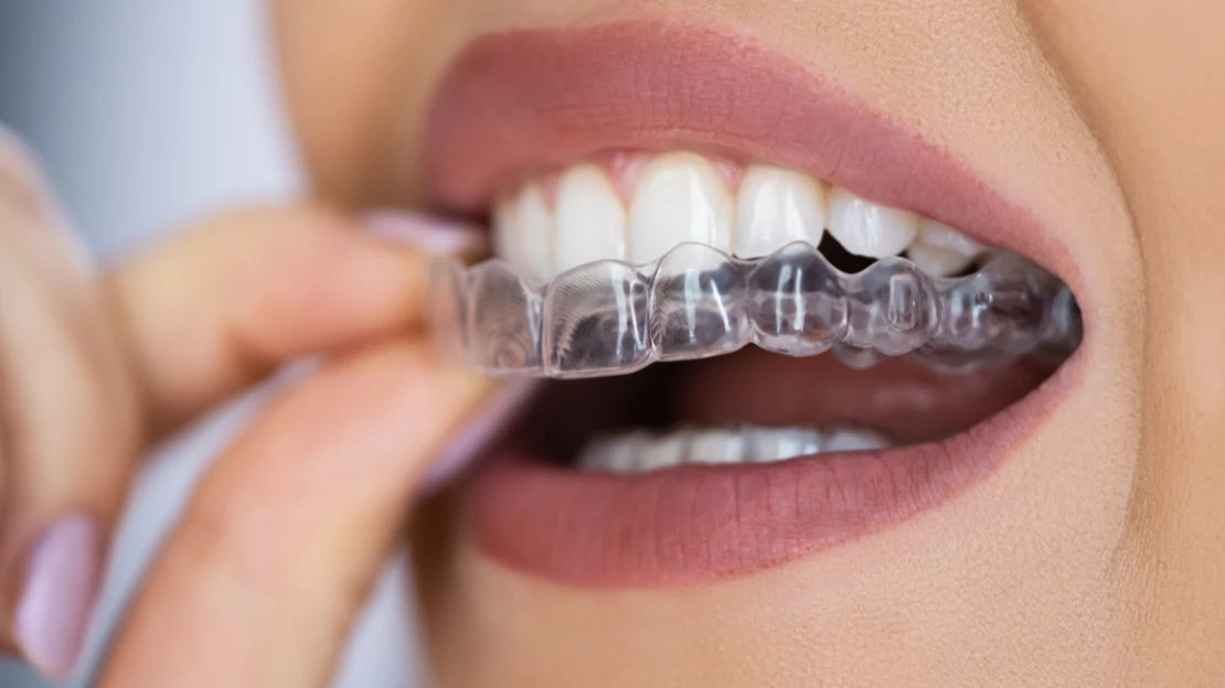 SEO Blog Invisalign Pain.png